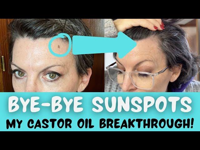 Sunspot SOS | The Castor Oil Hack That Saved My Skin