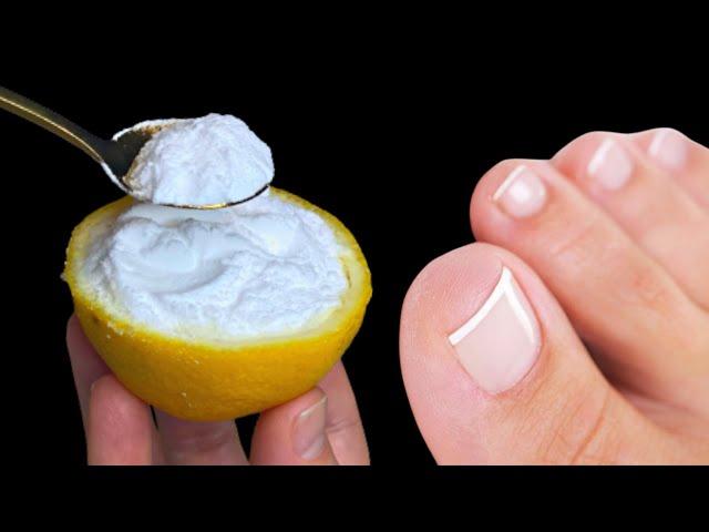 Instantly removes nail fungus like an eraser! The best natural remedy! 100 efficiency