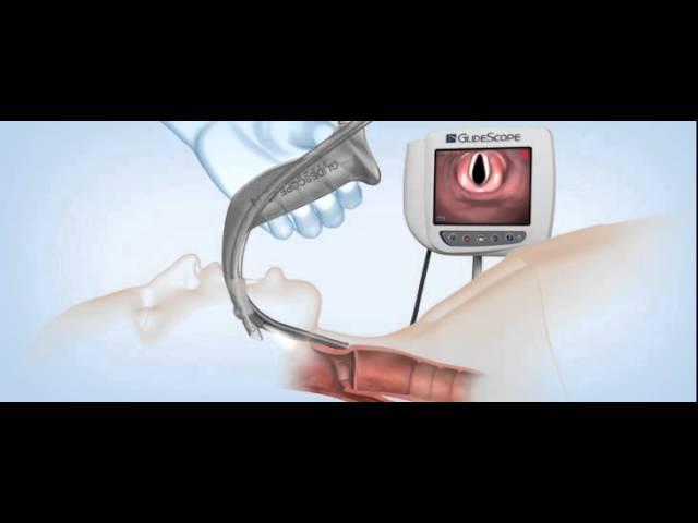 GlideScope Titanium Video Laryngoscopes Demonstration