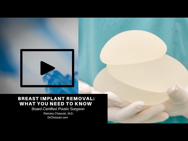 Breast Implant Removal: What You Need to Know | Ramsey Choucair, M.D.| Dallas, TX | Ph: 214-389-9797