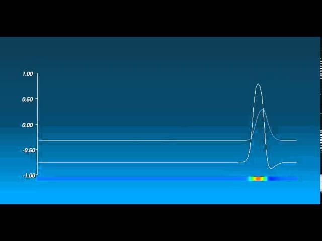 Action Potential 2 - William Edward Hahn