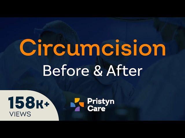 Before v/s After Laser Circumcision Surgery - For FREE Consultation Call On 6366526482