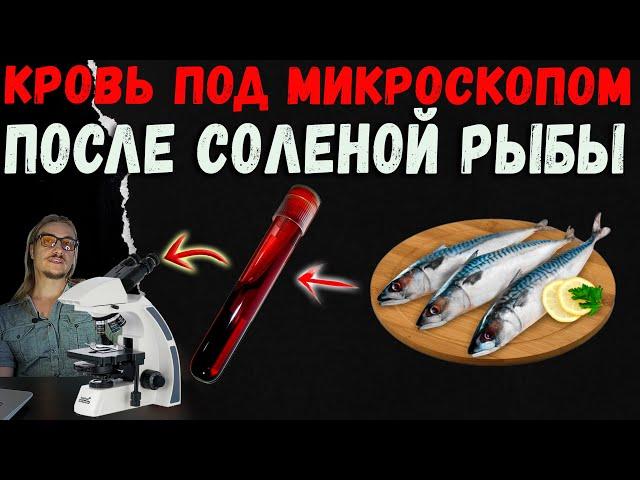 Кровь под микроскопом после соленой рыбы  (скумбрия)