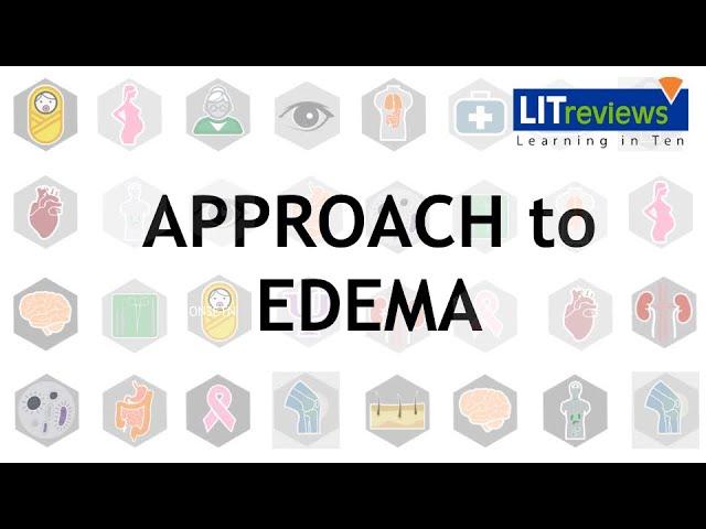 Approach To Edema