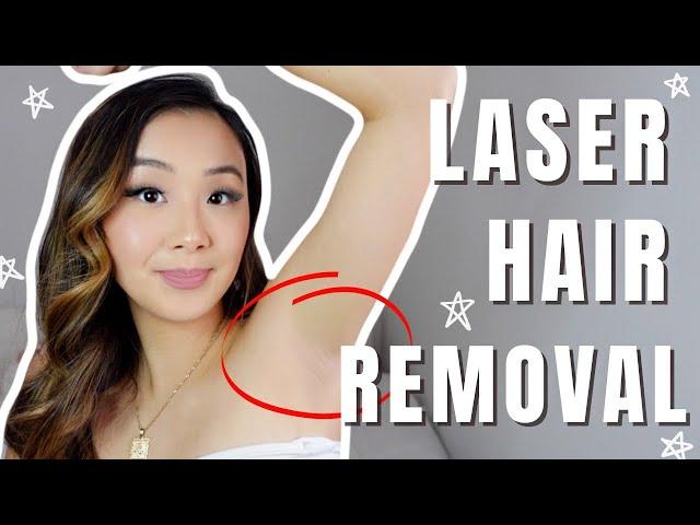 LASER HAIR REMOVAL EXPERIENCE + FAQ | brazillian & underarms