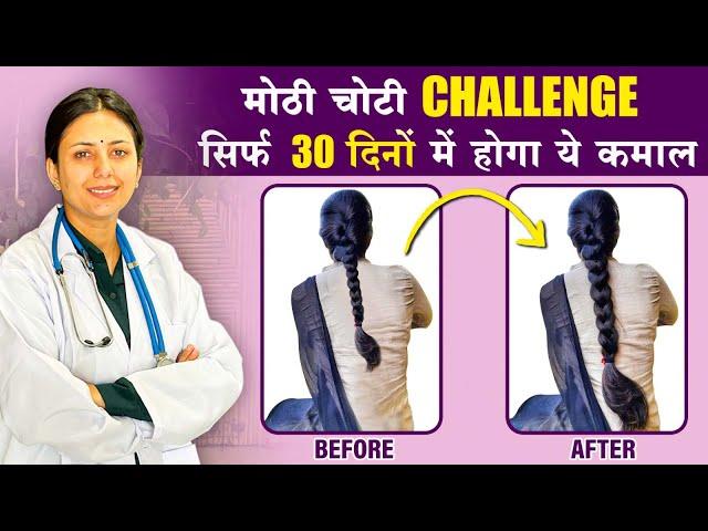 30 Days Challenge | इस उपाय से, बालों को मिलेगी दोगुनी तेजी से उगने की शक्ति️ | Upasana Ki Duniya