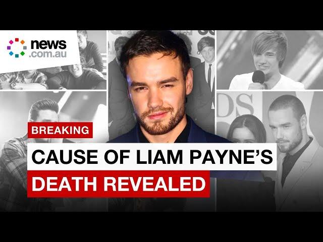 Liam Payne's cause of death revealed