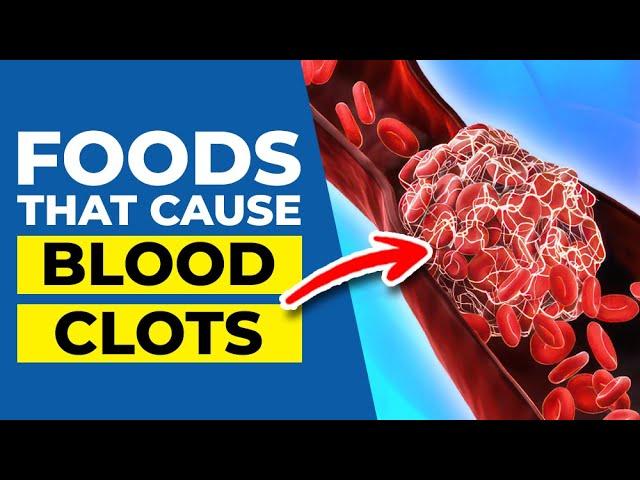 7 Worst Foods that Cause Blood Clots