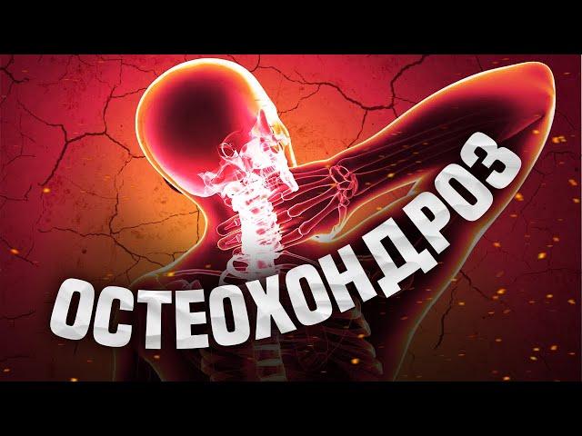 ОСТЕОХОНДРОЗ|| КАК ПОЛУЧИТЬ ВОЕННЫЙ БИЛЕТ|| НЕ БАЙТ!