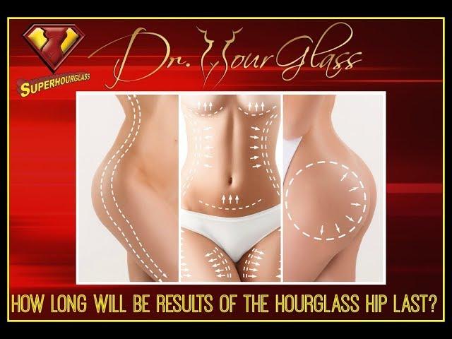 How Long Will Be Results of Hourglass Hip Last | Dr.Cortes