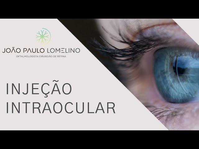 Injeção Intra Ocular com Dr João Paulo Lomelino