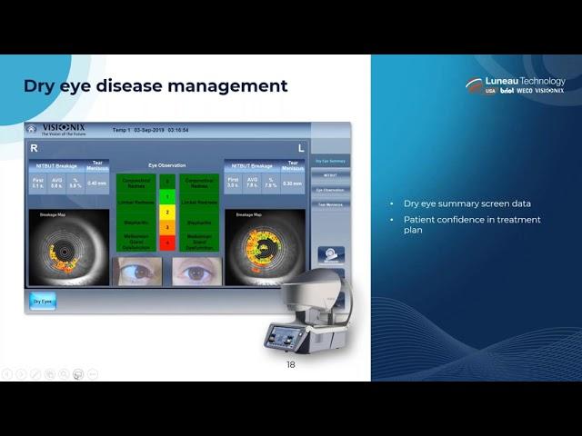 Refining the Role of your Optical Techs to Grow Your Practice - Dr. Gregory O'Connor