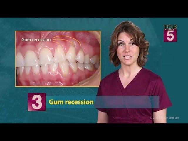 Top 5 Symptoms of Gum Disease