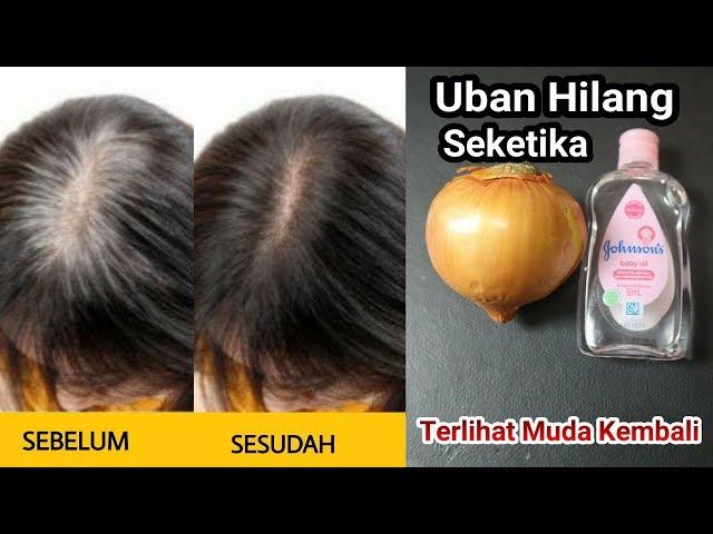 Cara Menghilangkan Uban Secepat Kilat Dengan Bahan yang Mudah Didapat