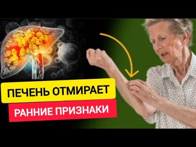 Вашей ПЕЧЕНИ Грозит Опасность: 10 ранних Признаков того, что ваша ПЕЧЕНЬ ОТМИРАЕТ