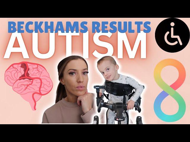 Beckham has officially been TESTED for AUTISM | His Results