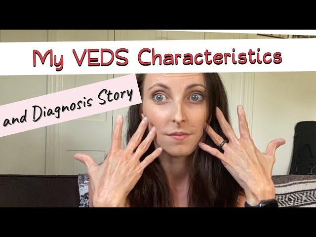 My VEDS Characteristics and Diagnosis Story (Vascular Ehlers-Danlos syndrome)