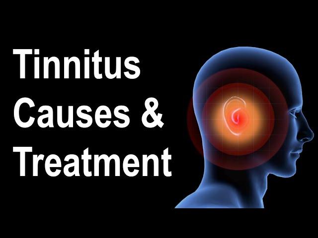 What is Tinnitus? Causes & Treatment Strategies