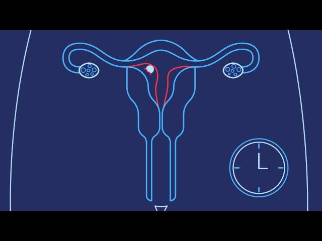 How Do You Get Pregnant? | Planned Parenthood Video