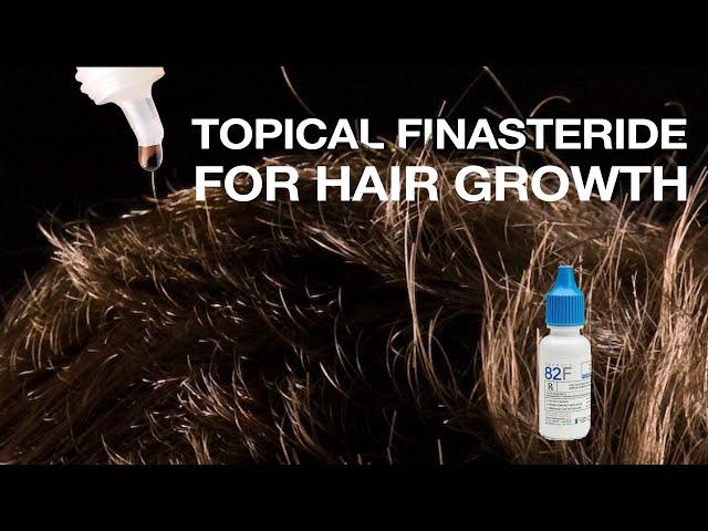 Does Topical Finasteride for Hair Growth have Fewer Side-Effects?