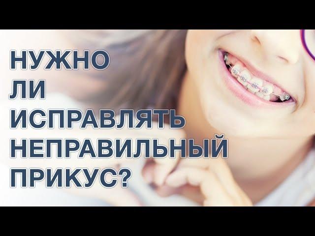 Неправильный прикус. Нужно ли исправлять прикус?