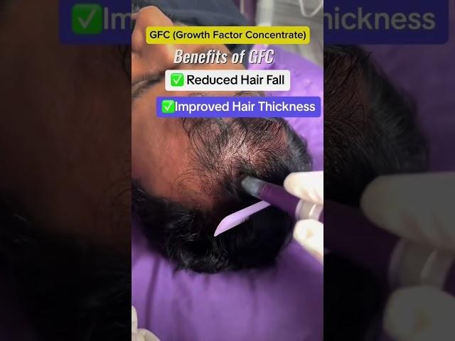 You Won’t Believe the latest from hairfall treatment GFC #hairtreatment