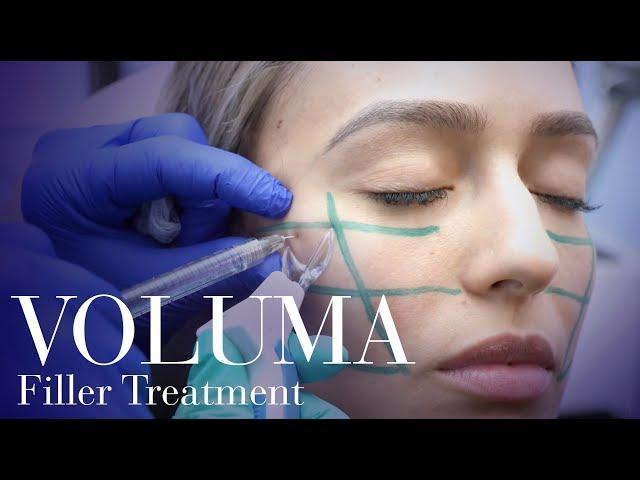 Runway Cheeks! Voluma Cheek Filler