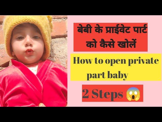How To Open Baby Boy Private Part |बेबी बॉय का सुसु कैसे खोले |बेबी बॉय का प्राइवेट पार्ट कैसे खोलें