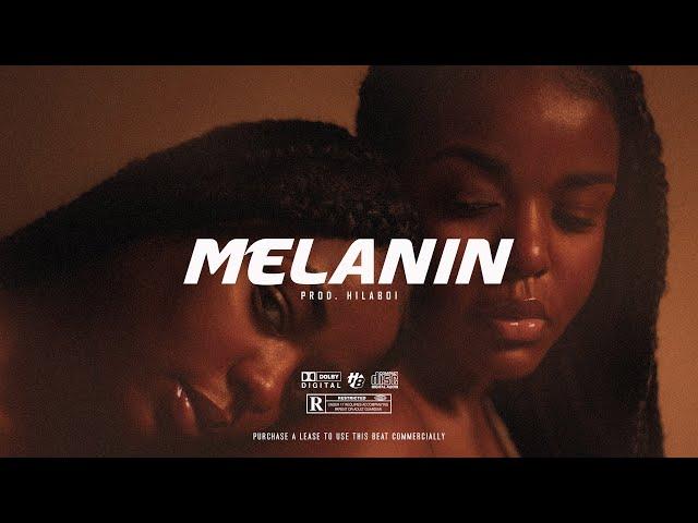 "Melanin" - Rema x Omah Lay x Wizkid Type Beat