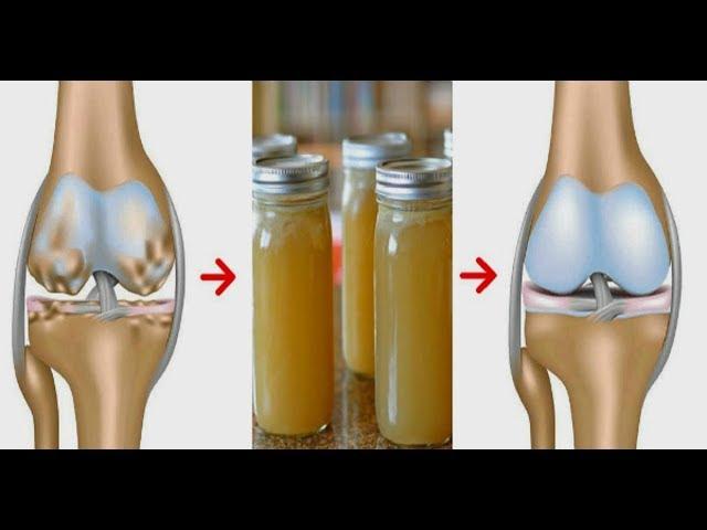 Лечение суставов ЖЕЛАТИНОМ и лимонным соком. Кости и суставы больше не тревожат.