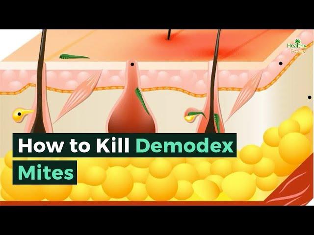 How to Kill Demodex Mites