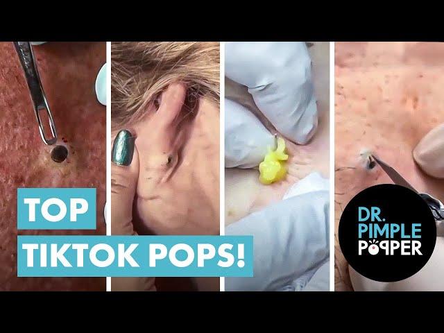 Dr Pimple Popper’s Top 10 Tiktok Pops