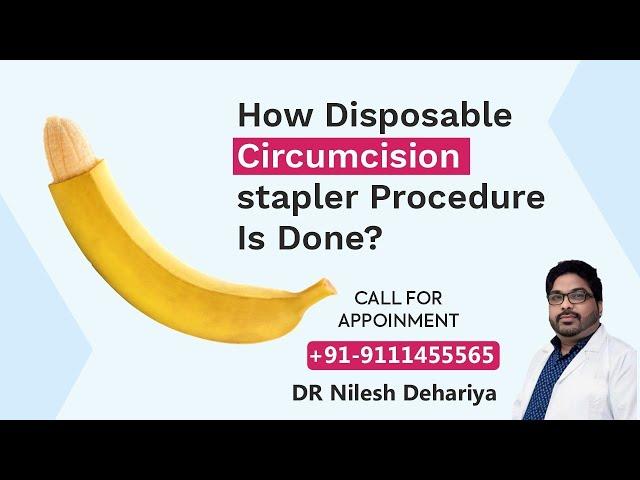 How Disposable circumcision stapler Procedure is Done?