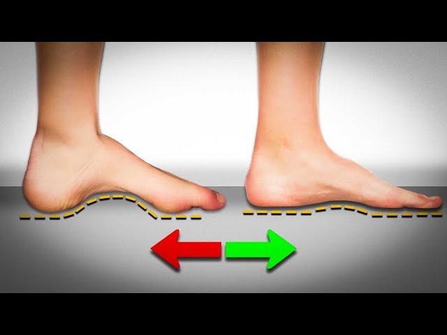 Fix Your High Foot Arch In One Easy Exercise