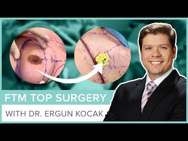 FTM Top Surgery by Dr. Ergun Kocak