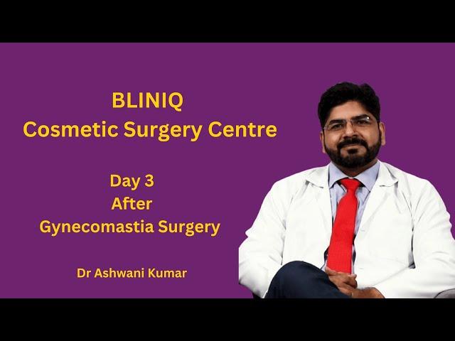 Patient Experience after 3rd day of Gynecomastia Surgery