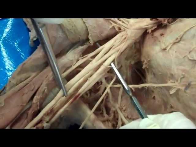 Brachial Plexus