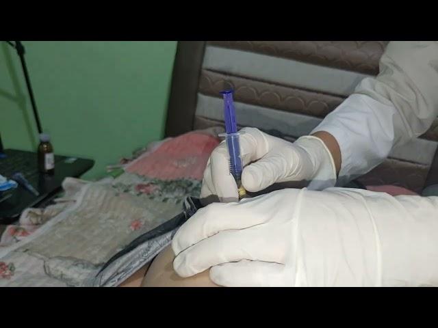 intramuscular injection 