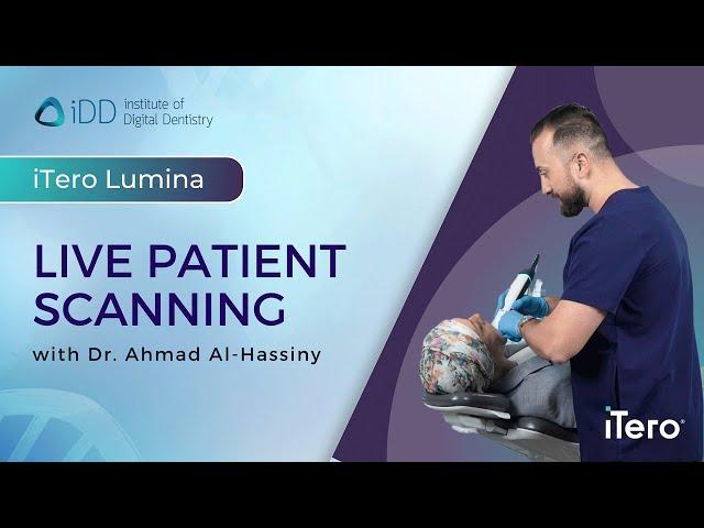 iTero Lumina Intraoral Scanner - Live Patient Full Arch Scanning Demonstration | iDD