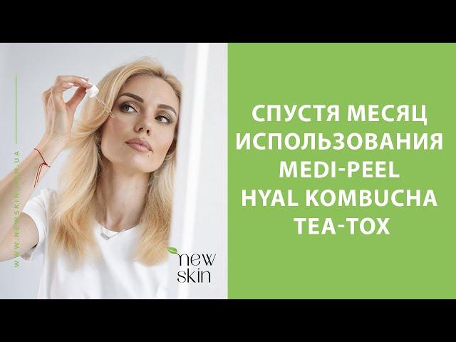 Medi-Peel Hyal Kombucha Tea-Tox Ampoule, Cream, Toner – отзыв и впечатления о новинке Меди Пил 2023