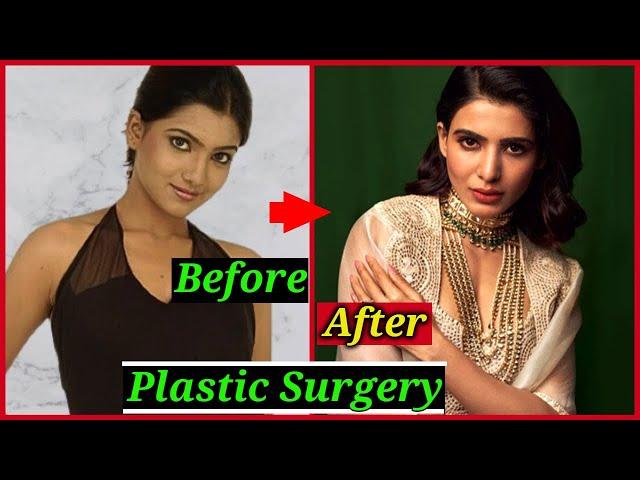 Shocking Plastic Surgery of South Indian Actresses | Samantha Akkineni, Kajal Aggarwal, Anushka