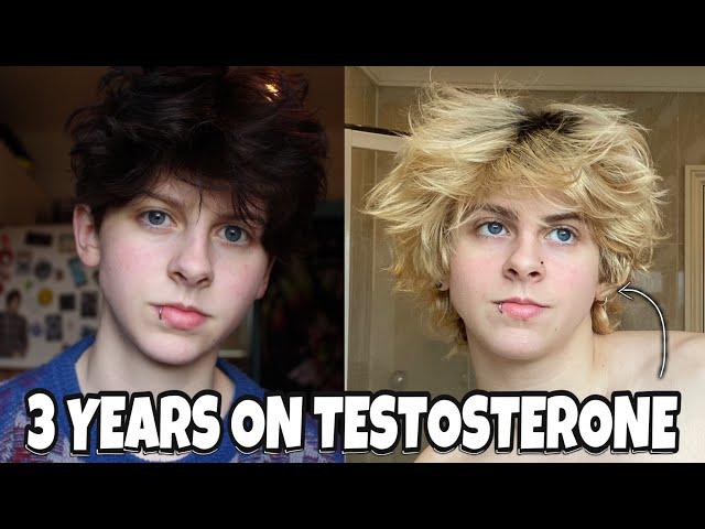 3 YEARS ON TESTOSTERONE (FTM TRANSGENDER) | NOAHFINNCE