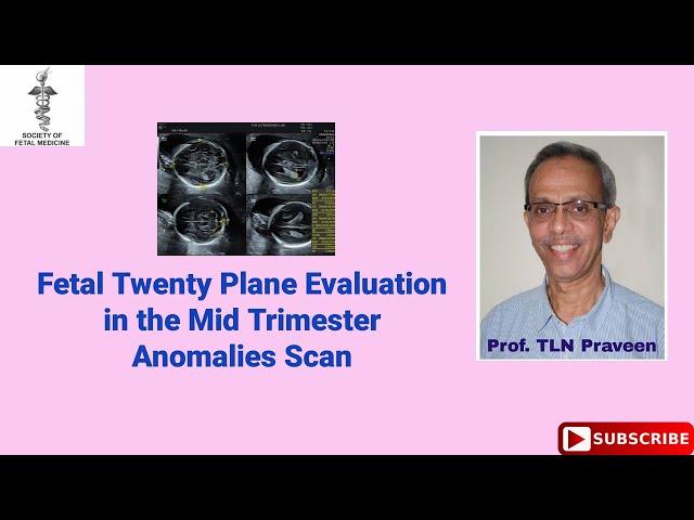 Fetal Twenty Plane Evaluation in the Mid trimester Anomalies Scan