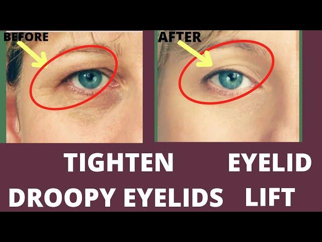 LIFT DROOPY EYELIDS + FACE YOGA AND MASSAGE