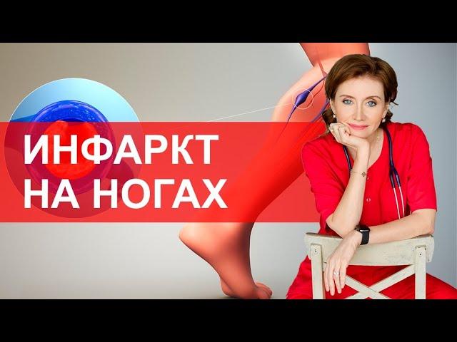 Инфаркт на ногах