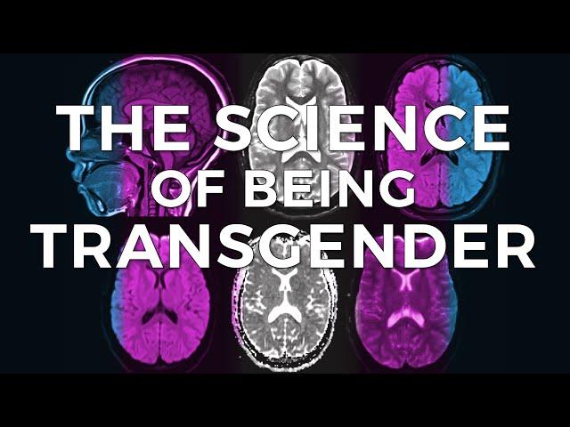 The Science of Being Transgender