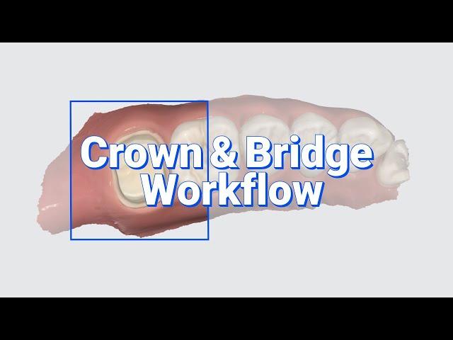 Crown & Bridge Workflow
