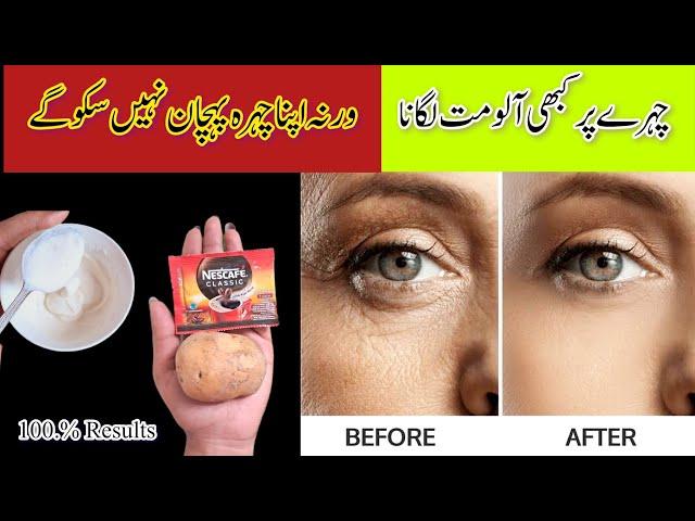 When I Try this Magical skin whitening cream | Remove Dark Spots Pigmentation treatment| Home Remedy