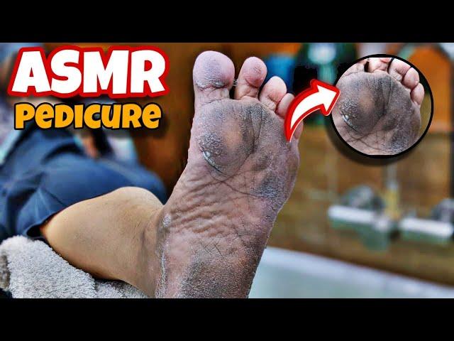 ASMR! pedicure Dirty Feet very especially and easily Scraps / cleanup feet / Footcare33 