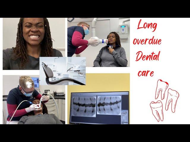 A day in the life of a Nigerian student Mum in Germany | Dental care Vlog - long overdue PART 1